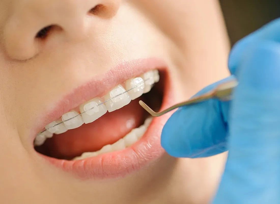 Preventive Dentistry at Marconi Dental Group in Carmichael, CA