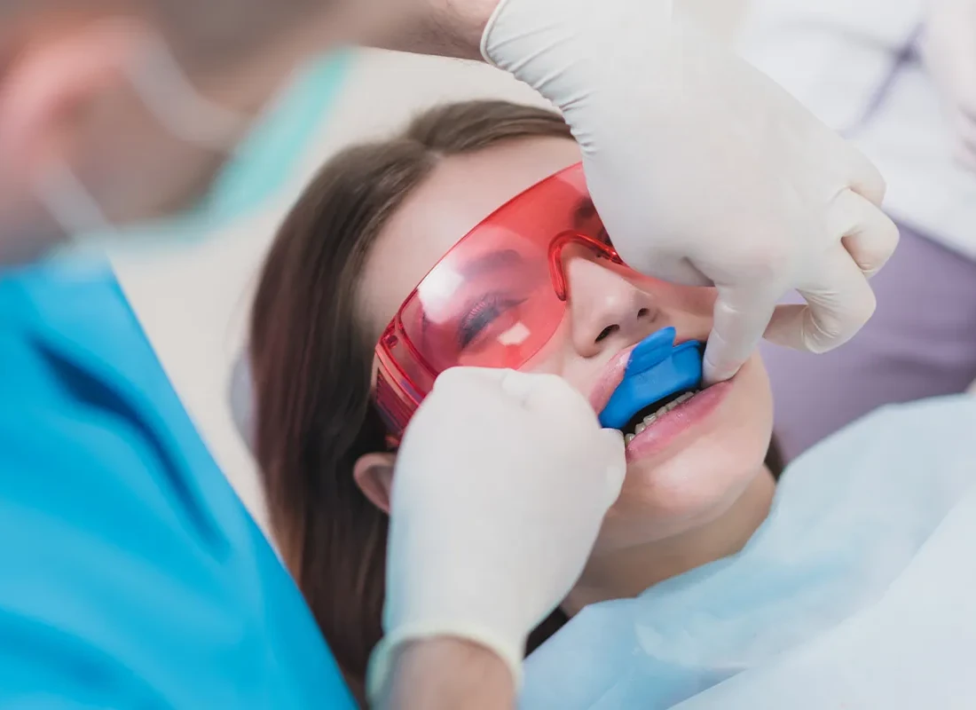 Fluoride Treatments at Marconi Dental Group in Carmichael, CA