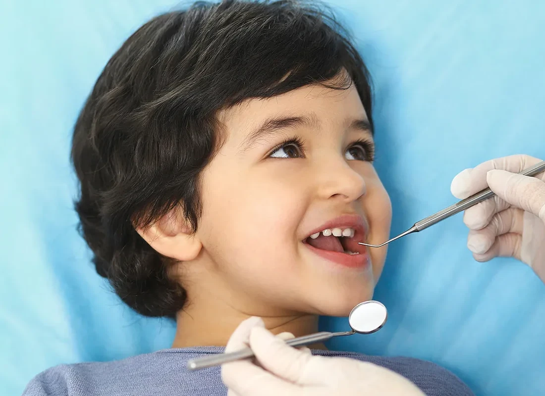 Dental Sealants at Marconi Dental Group in Carmichael, CA