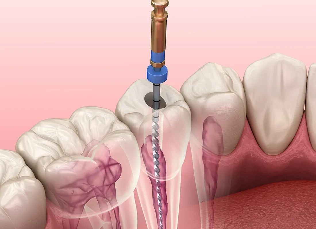 How Long Does Lidocaine Last?