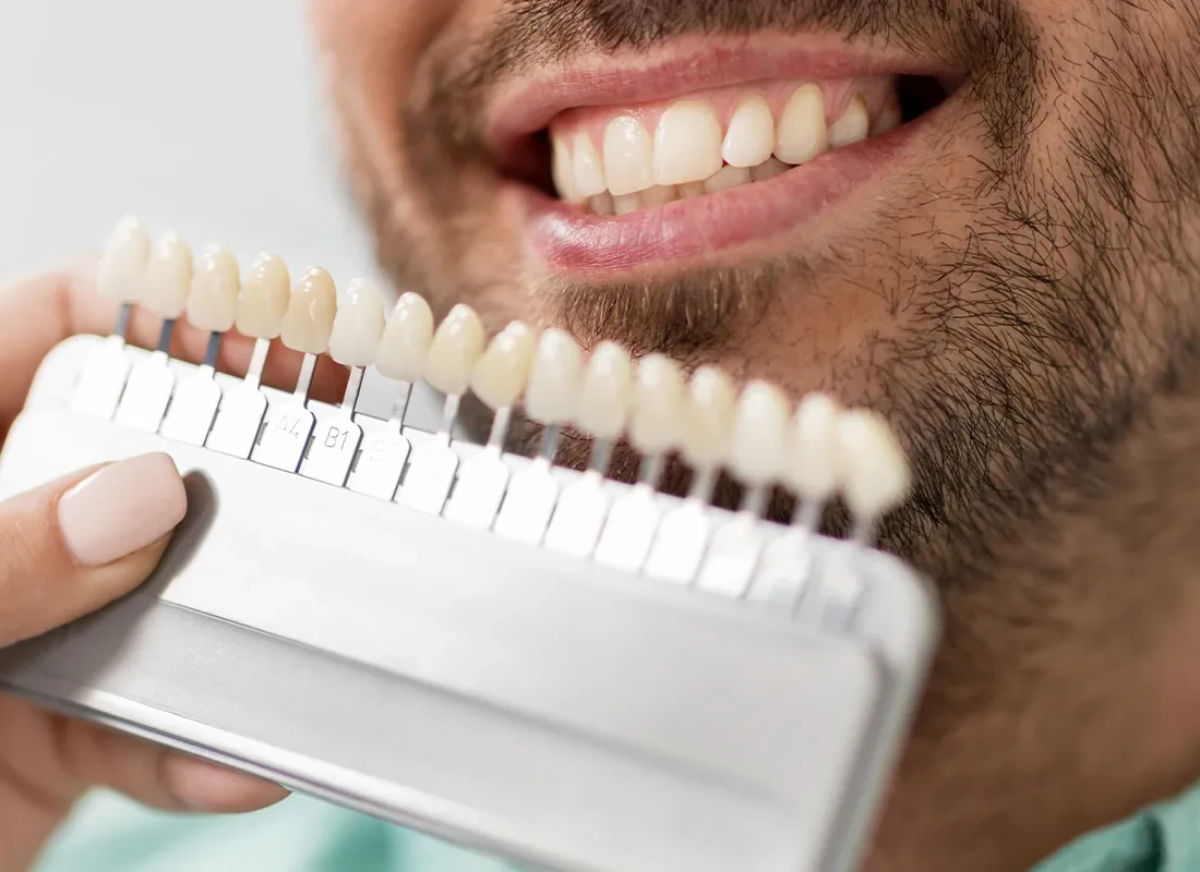 Teeth Whitening at Marconi Dental Group in Carmichael, CA