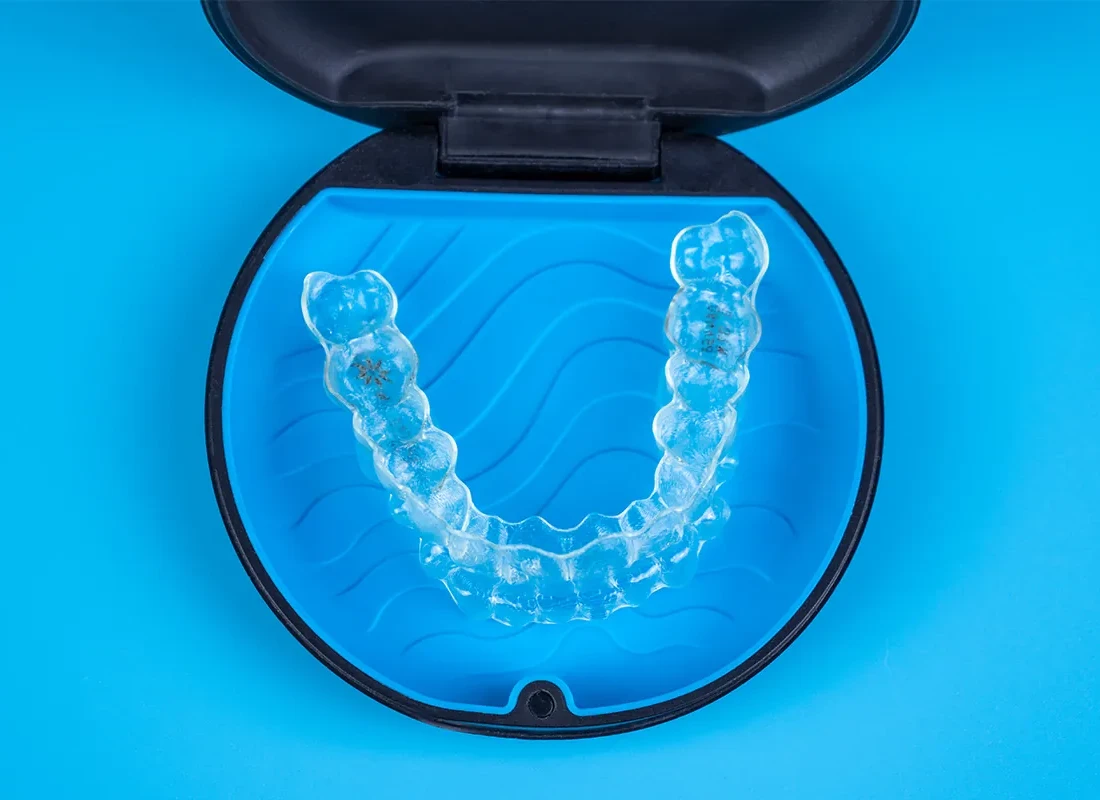Signs you may need Invisalign Clear Aligners — Marconi Dental Group