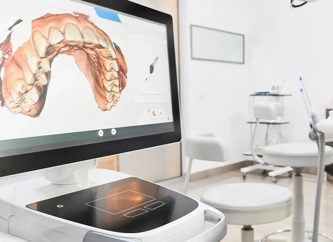 Signs you may need Full Mouth Reconstruction — Marconi Dental Group