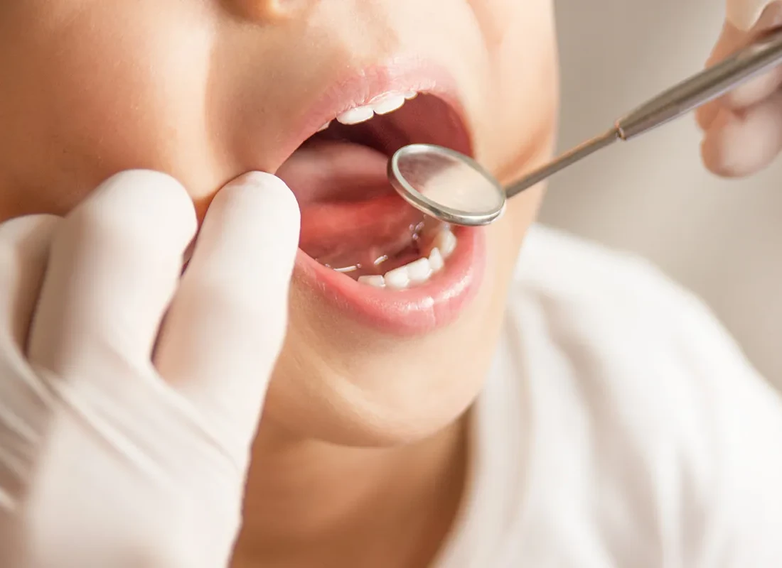 Signs you may need Pediatric Care — Marconi Dental Group