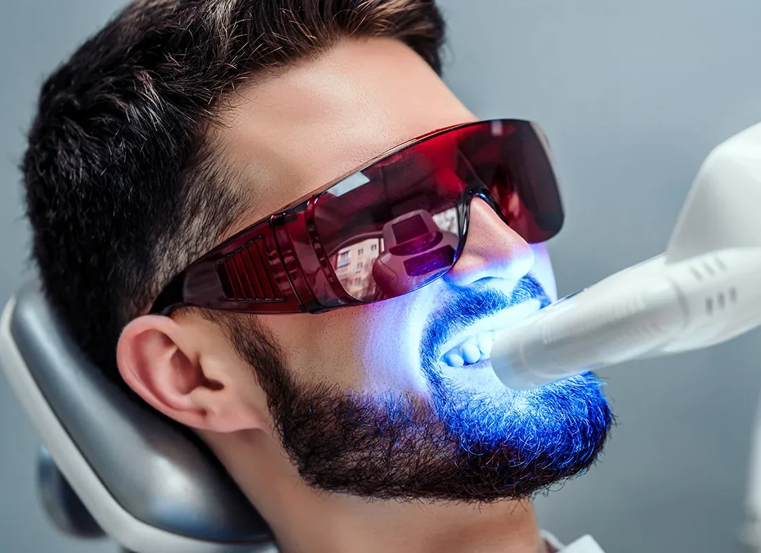 Signs you may need Teeth Whitening — Marconi Dental Group